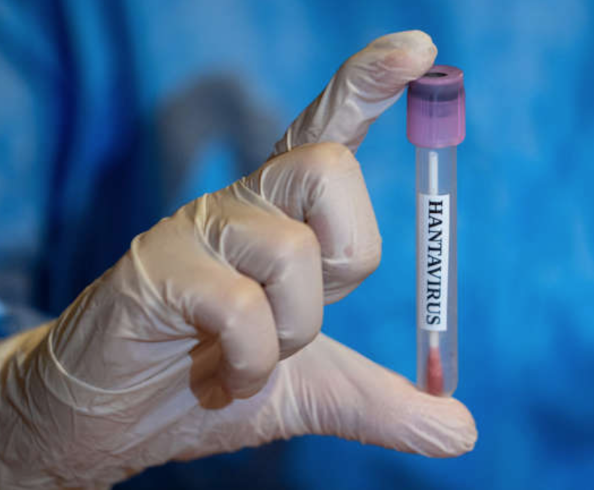 'El Niño' podría desencadenar un brote de hantavirus en Estados Unidos este verano