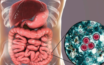 Se confirman tres casos de cyclospora en México; Salud descarta brote y niega vínculo con contagios en EEUU