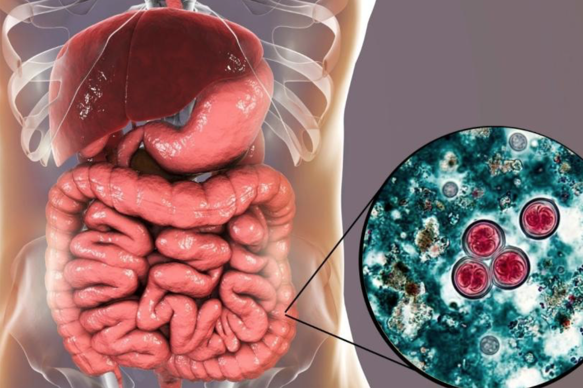 Se confirman tres casos de cyclospora en México; Salud descarta brote y niega vínculo con contagios en EEUU