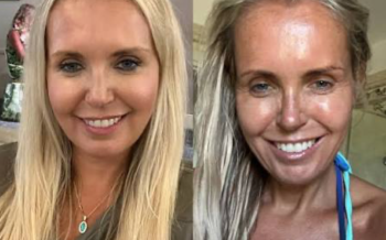 'Cortisol face', la nueva obsesión de la belleza. ¿Qué tiene que ver con el estrés?