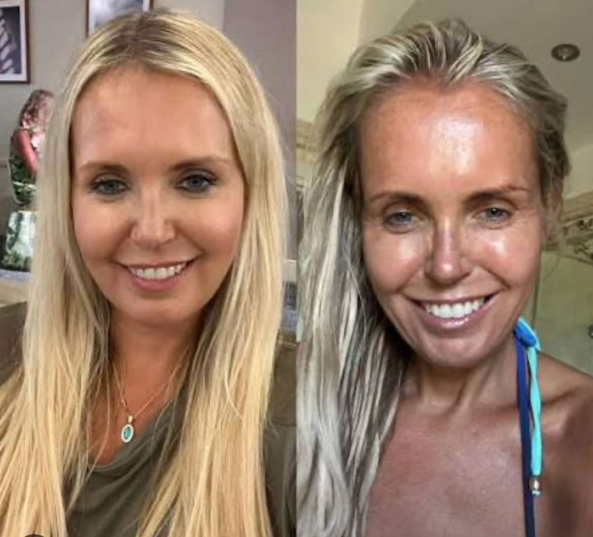 'Cortisol face', la nueva obsesión de la belleza. ¿Qué tiene que ver con el estrés?